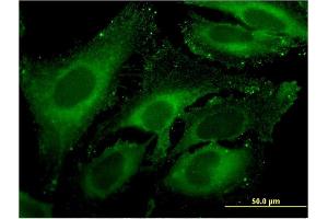 Immunofluorescence of monoclonal antibody to CPA4 on HeLa cell.