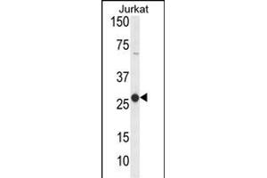 Western blot analysis of C Antibody (Center) (ABIN653826 and ABIN2843094) in Jurkat cell line lysates (35 μg/lane). (CD160 Antikörper  (AA 56-82))
