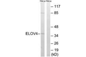 Western blot analysis of extracts from HeLa cells, using ELOVL4 Antibody.