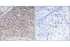 Immunohistochemistry analysis of paraffin-embedded human testis tissue, using MAST4 Antibody. (MAST4 Antikörper  (AA 251-300))