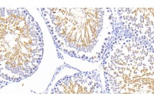 Detection of HSPA1L in Rat Testis Tissue using Polyclonal Antibody to Heat Shock 70 kDa Protein 1 Like Protein (HSPA1L) (HSPA1L Antikörper  (AA 1-641))