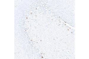 Immunohistochemistry (IHC) image for anti-Achaete-Scute Complex Homolog 1 (Drosophila) (ASCL1) (AA 186-236) antibody (ABIN7455113) (Rekombinanter ASCL1 Antikörper  (AA 186-236))