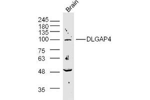 Rat brain lysates probed with SAPAP4/DLGAP4 Polyclonal Antibody, unconjugated  at 1:300 overnight at 4°C followed by a conjugated secondary antibody at 1:10000 for 90 minutes at 37°C. (DLGAP4 Antikörper  (AA 261-370))