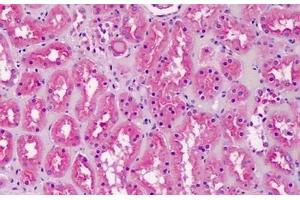 Human Kidney: Formalin-Fixed, Paraffin-Embedded (FFPE) (CRLS1 Antikörper  (AA 161-174))