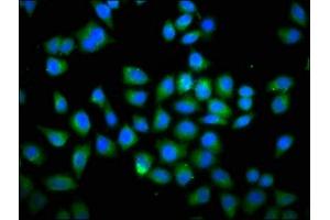 Immunofluorescence staining of Hela cells with ABIN7149579 at 1:66, counter-stained with DAPI. (DOCK1 Antikörper  (AA 1676-1865))