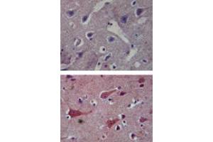 Immunohistochemical analysis of TLR8 in paraffin-embedded formalin-fixed human brain tissue using an isotype control (top) and TLR8 monoclonal antibody, clone 44C143  (bottom) at 5 ug/mL . (TLR8 Antikörper  (AA 750-850))