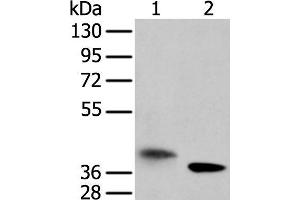 Western blot analysis of A172 cell and mouse kidney tissue using LRRC19 Polyclonal Antibody at dilution of 1:450