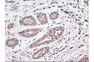 Immunohistochemical staining of paraffin-embedded breast using anti-Trim33 (ABIN2452535) mouse monoclonal antibody. (TRIM33 Antikörper  (AA 887-1046))
