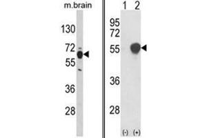 (LEFT) Western blot analysis of PHGDH Antibody (N-term) in mouse brain tissue lysates (35ug/lane). (PHGDH Antikörper  (N-Term))