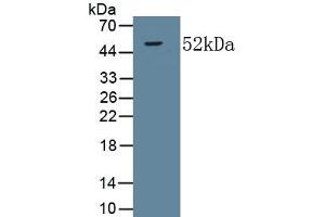 Detection of Recombinant COL5a2, Human using Monoclonal Antibody to Collagen Type V Alpha 2 (COL5a2) (COL5A2 Antikörper  (AA 82-308))