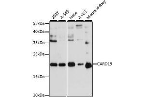Western blot analysis of extracts of various cell lines, using C antibody (ABIN6127784, ABIN6137941, ABIN6137942 and ABIN6217103) at 1:3000 dilution. (C9orf89 Antikörper  (AA 1-100))