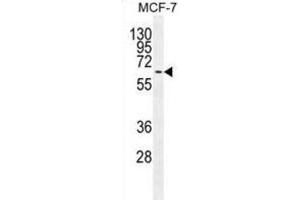 Western Blotting (WB) image for anti-Mitogen-Activated Protein Kinase 15 (MAPK15) antibody (ABIN2995325) (MAPK15 Antikörper)