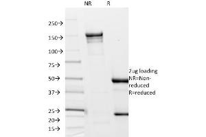 SDS-PAGE Analysis Purified Borrelia burgdorferi (p41 Flagellin) (6802).