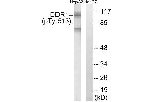Immunohistochemistry analysis of paraffin-embedded human brain tissue using DDR1 (Phospho-Tyr513) antibody.