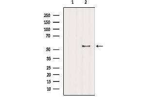 Western blot analysis of extracts from B16F10, using ZNF497 Antibody. (ZNF497 Antikörper)
