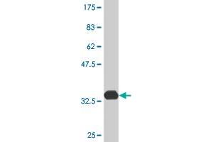Western Blot detection against Immunogen (33. (ATOX1 Antikörper  (AA 1-68))