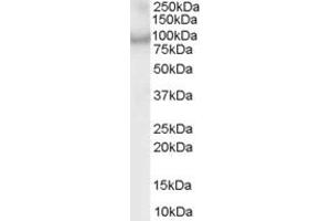 Western Blotting (WB) image for anti-ArfGAP with Coiled-Coil, Ankyrin Repeat and PH Domains 2 (ACAP2) (C-Term) antibody (ABIN185097)