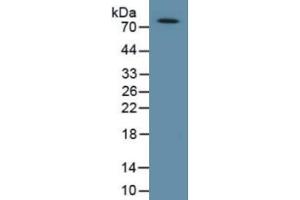Western Blotting (WB) image for Collagen, Type VIII, alpha 1 (COL8A1) ELISA Kit (ABIN6730964)