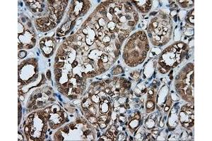 Immunohistochemical staining of paraffin-embedded liver tissue using anti-PPP5C mouse monoclonal antibody. (PP5 Antikörper)