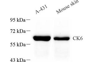 Western blot analysis of CK6 (ABIN7074423) at dilution of 1: 1000 (Keratin 6 Antikörper)