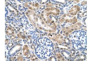 SLC22A3 antibody was used for immunohistochemistry at a concentration of 4-8 ug/ml to stain Epithelial cells of renal tubule (arrows) in Human Kidney. (SLC22A3 Antikörper)