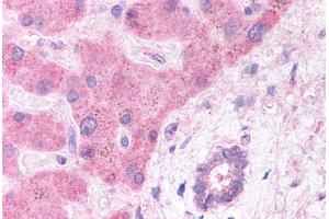 Human Hepatocytes and Bile Duct (formalin-fixed, paraffin-embedded) stained with LRP6 antibody ABIN291653 at 5 ug/ml followed by biotinylated anti-goat IgG secondary antibody ABIN481715, alkaline phosphatase-streptavidin and chromogen. (LRP6 Antikörper  (AA 1547-1560))