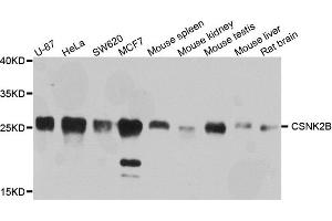 Western blot analysis of extracts of various cells, using CSNK2B antibody. (CSNK2B Antikörper)