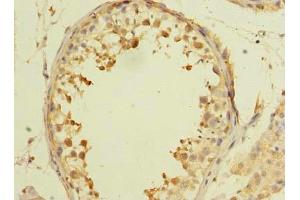 Immunohistochemistry of paraffin-embedded human testis tissue using ABIN7143633 at dilution of 1:100 (AARSD1 Antikörper  (AA 1-230))