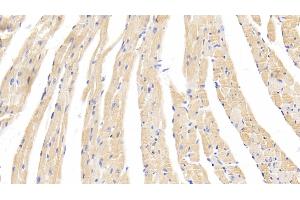 Immunohistochemistry (IHC) image for anti-Caspase 1 (CASP1) (AA 119-296) antibody (ABIN7437506)