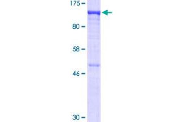 USO1 Protein (AA 1-961) (GST tag)