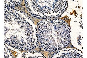 ABIN7095331 and ABIN7099388 at 1/100 staining mouse testis tissue by IHC-P.