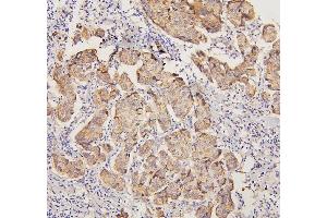 IHC analysis of PYROXD1 using anti-PYROXD1 antibody (ABIN6719650). (PYROXD1 Antikörper  (AA 48-230))