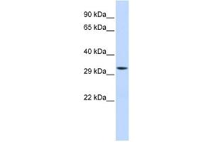 WB Suggested Anti-MTIF3 Antibody Titration: 0. (MTIF3 Antikörper  (Middle Region))