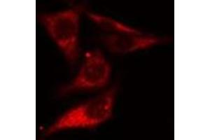 ABIN6275494 staining Hela cells by IF/ICC. (ARHGEF10 Antikörper  (Internal Region))