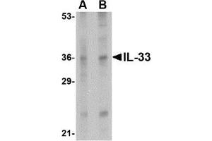 Western blot analysis of IL-33 in human lymph node tissue lysate with AP30427PU-N IL-33 antibody at (A) 1 and (B) 2 μg/ml. (IL-33 Antikörper  (Center))