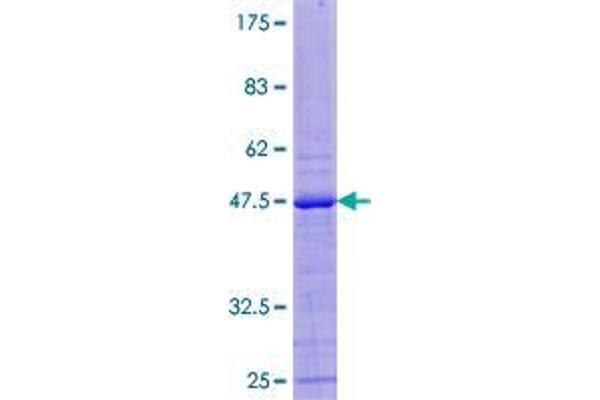 ZNF576 Protein (AA 1-170) (GST tag)