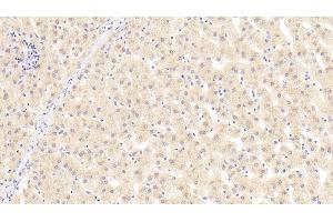 Immunohistochemistry (IHC) image for anti-Angiogenin (ANG) (AA 25-147) antibody (ABIN7430312)