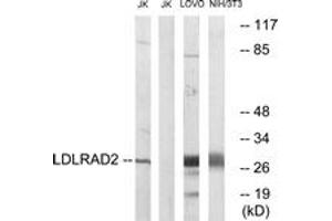 Western blot analysis of extracts from Jurkat/LOVO/NIH-3T3 cells, using LDLRAD2 Antibody. (LDLRAD2 Antikörper  (AA 130-179))
