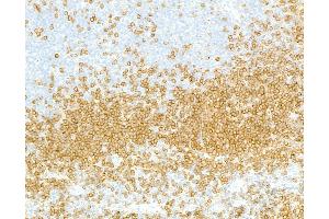 Immunohistochemistry (IHC) image for anti-B-cell antigen receptor complex-associated protein alpha chain (CD79A) (AA 176-226) antibody (ABIN7454004)