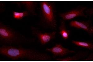 Immunofluorescence (IF) image for anti-Copper Chaperone For Superoxide Dismutase (CCS) (AA 1-274) antibody (APC) (ABIN5565328) (Superoxide dismutase copper chaperone Antikörper  (AA 1-274) (APC))