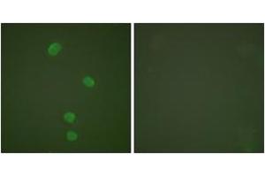 Immunofluorescence analysis of HepG2 cells, using MCM5 Antibody. (MCM5 Antikörper  (AA 21-70))