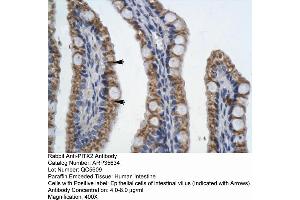 Human Intestine (PITX2 Antikörper  (N-Term))