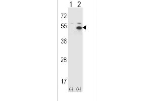 Western Blotting (WB) image for anti-Signal Transducing Adaptor Molecule (SH3 Domain and ITAM Motif) 1 (STAM) (AA 326-356), (C-Term) antibody (ABIN388974)