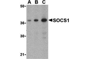 Western Blotting (WB) image for anti-Suppressor of Cytokine Signaling 1 (SOCS1) (C-Term) antibody (ABIN1030688) (SOCS1 Antikörper  (C-Term))