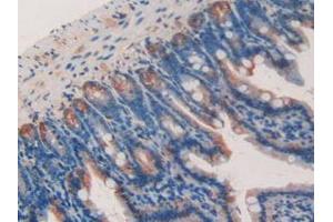 IHC-P analysis of Mouse Kidney Tissue, with DAB staining. (Galectin 9 Antikörper  (AA 225-353))