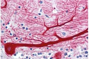 Immunohistochemistry (IHC) image for anti-Wingless-Type MMTV Integration Site Family, Member 10B (WNT10B) (Internal Region) antibody (ABIN1049470)