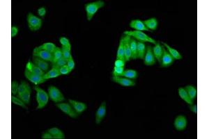 Immunofluorescence staining of HepG2 cells with ABIN7149816 at 1:66, counter-stained with DAPI. (DPPA5 Antikörper  (AA 1-116))