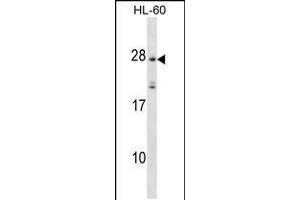 Western blot analysis in HL-60 cell line lysates (35ug/lane). (MS4A5 Antikörper  (N-Term))