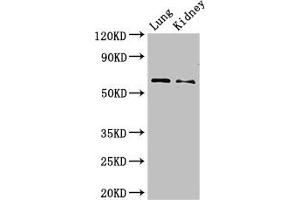 Western Blot Positive WB detected in: Mouse lung tissue, Mouse kidney tissue All lanes: Plbd2 antibody at 3 μg/mL Secondary Goat polyclonal to rabbit IgG at 1/50000 dilution Predicted band size: 66 kDa Observed band size: 66 kDa (PLBD2 Antikörper  (AA 36-585))