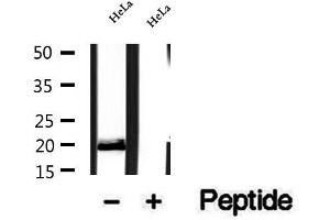 Western Blotting (WB) image for anti-Optic Atrophy 3 (Autosomal Recessive, with Chorea and Spastic Paraplegia) (OPA3) (Internal Region) antibody (ABIN6263824)